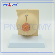 PNT-0747 life size female breast anatomical model